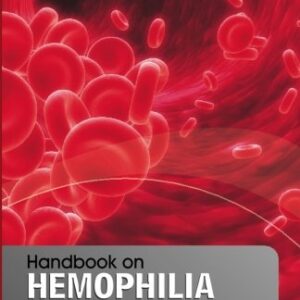 Handbook on hemophilia and other bleeding disorders