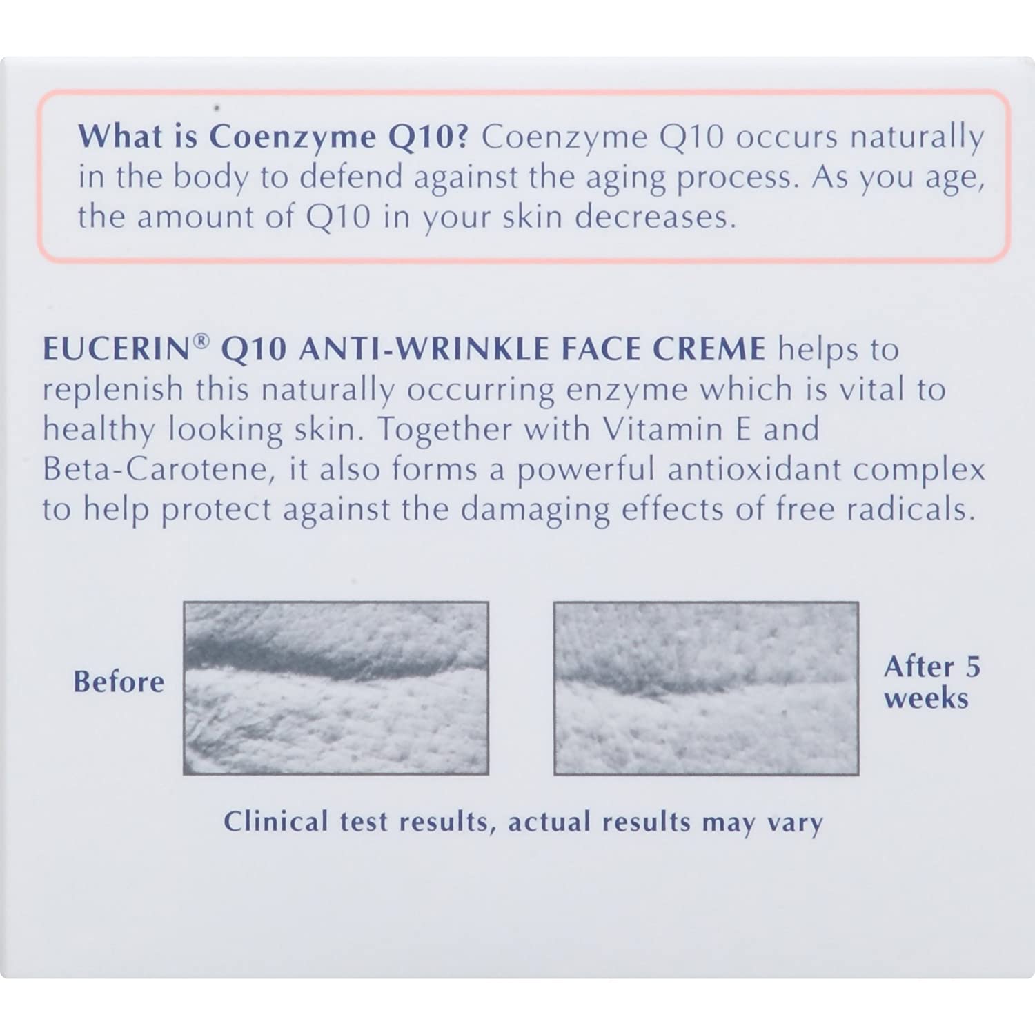 Eucerin Sensitive Skin Experts Q10 Anti-Wrinkle Face Creme 1.70 oz ( Pack of 4)