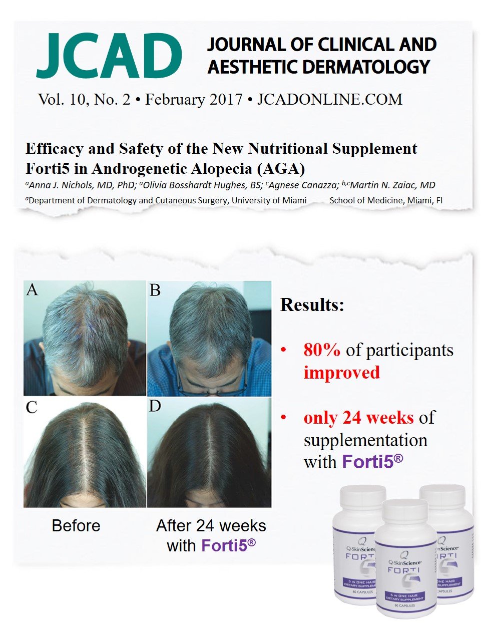 Quintessence Forti5 Hair Growth Nutritional Supplement and Vitamins with 5 Plus1 Key Substances, 1 Month Supply - 60 Caps.