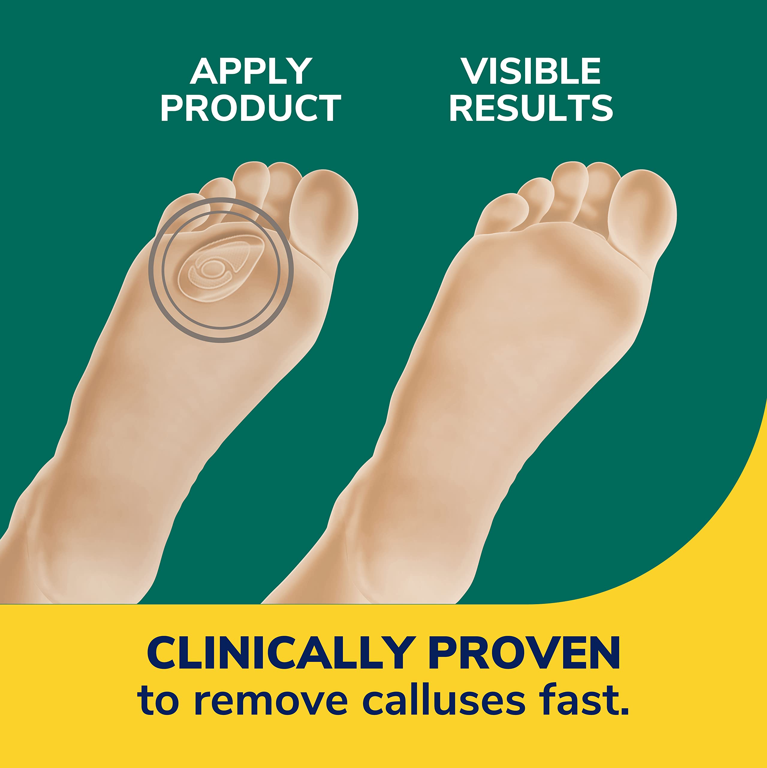 Dr. Scholl's CALLUS REMOVER Seal & Heal Bandage with Hydrogel Technology, 4ct // Removes Calluses Fast And Provides Cushioning Protection Against Shoe Pressure And Friction For All-Day Pain Relief