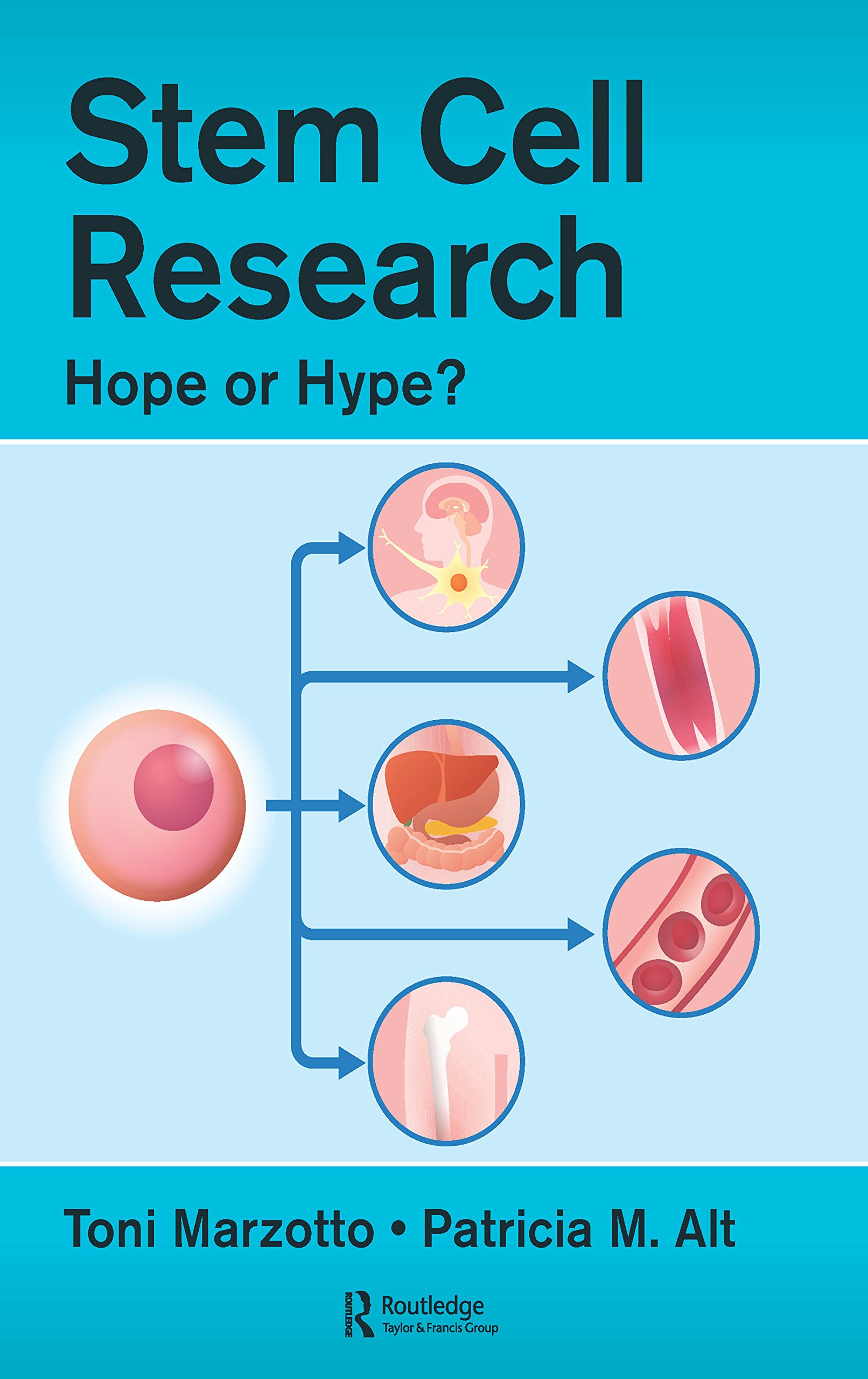 Stem Cell Research: Hope or Hype?