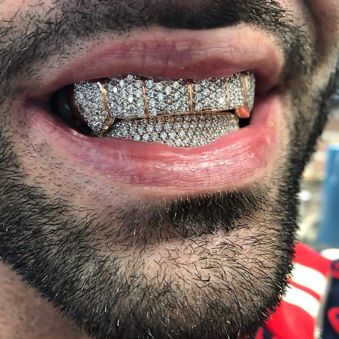 TOPGRILLZ Diamond Grills 18K Gold Plated Fully Iced Out CZ Vampire Top and Bottom Face Mouth Silver Grillz for Your Teeth Men Women with Extra Molding Bars