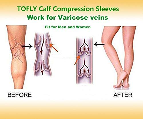 TOFLY® Calf Compression Sleeve for Men & Women, 1 Pair, Footless Compression Socks 20-30mmHg for Leg Support, Shin Splint, Pain Relief, Swelling, Varicose Veins, Maternity, Nursing, Travel, Beige XL