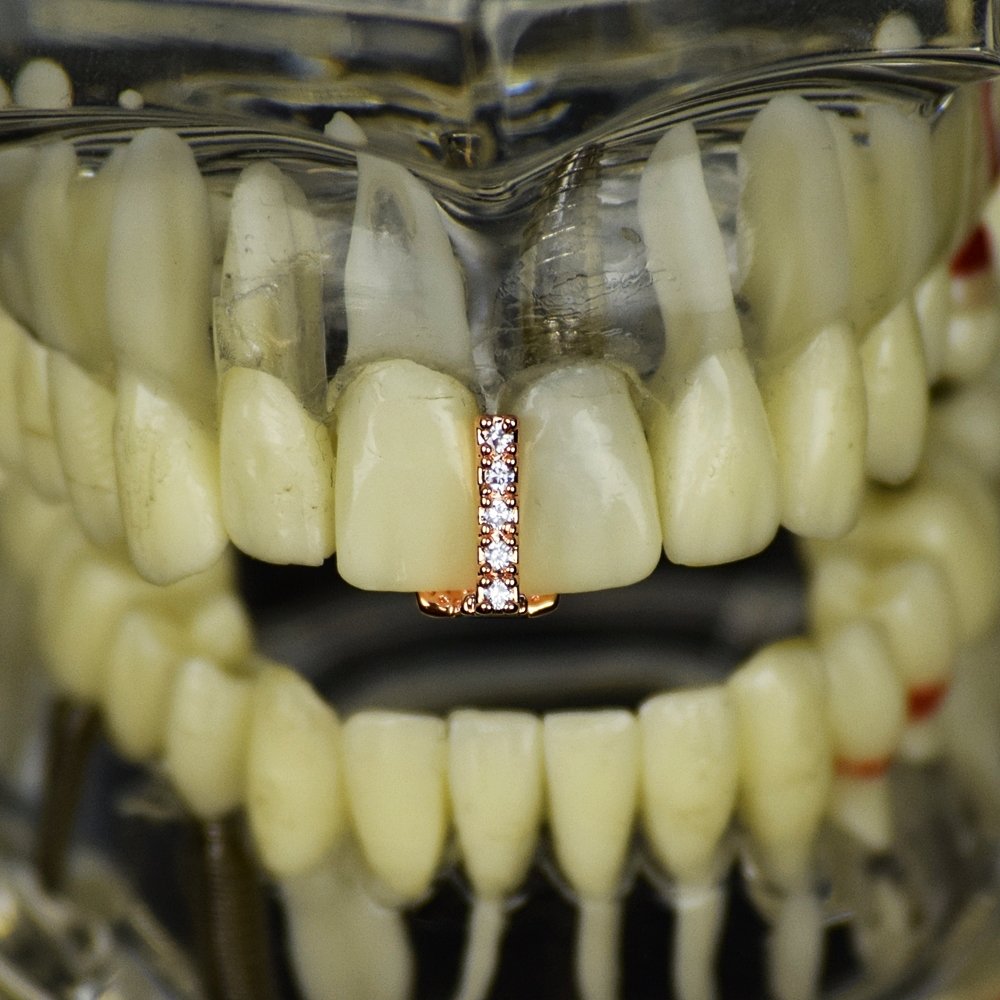 CZ Gap Grillz 14k Rose Gold Plated Cubic Zirconia Bling Tooth Top or Bottom Teeth Single Cap Hip Hop Grills