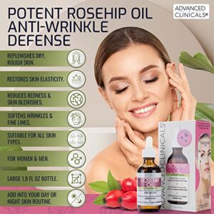 Advanced Clinicals Rosehip Oil Facial Skin Care Serum Moisturizer Face Oil W/Vitamin C & Vitamin E For Reducing Appearance Of Sun Damage Skin, Age Spots, & Wrinkles, 1.8 Fl Oz (Pack of 2)