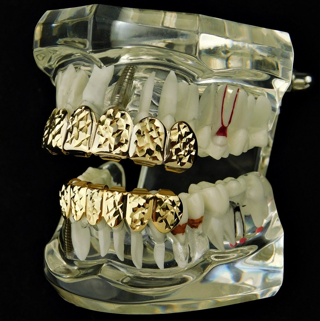 14k Gold Plated Grillz Set Diamond-Cut Grill Top & Bottom 12 Teeth Hip Hop Grills