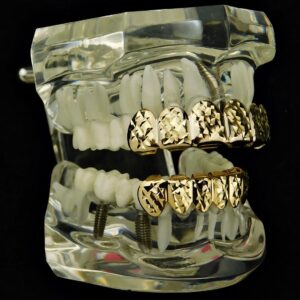 14k Gold Plated Grillz Set Diamond-Cut Grill Top & Bottom 12 Teeth Hip Hop Grills