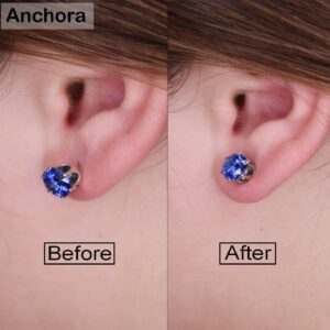 ANCHORA Original Earring Backs for Droopy Ears | Earring Lifters for Heavy Earring | Earing Lifter Backs Backs | Earlobe Secure