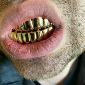 Solid 925 Sterling Silver Real Grillz - 14k Gold Plated - Custom Top & Bottom Grills For Teeth - Real Solid Silver NOT BRASS