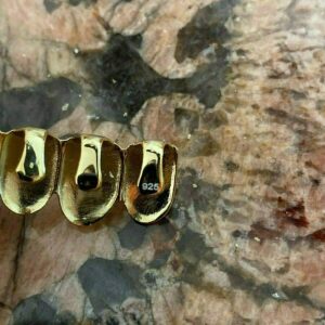 Solid 925 Sterling Silver Real Grillz - 14k Gold Plated - Custom Top & Bottom Grills For Teeth - Real Solid Silver NOT BRASS