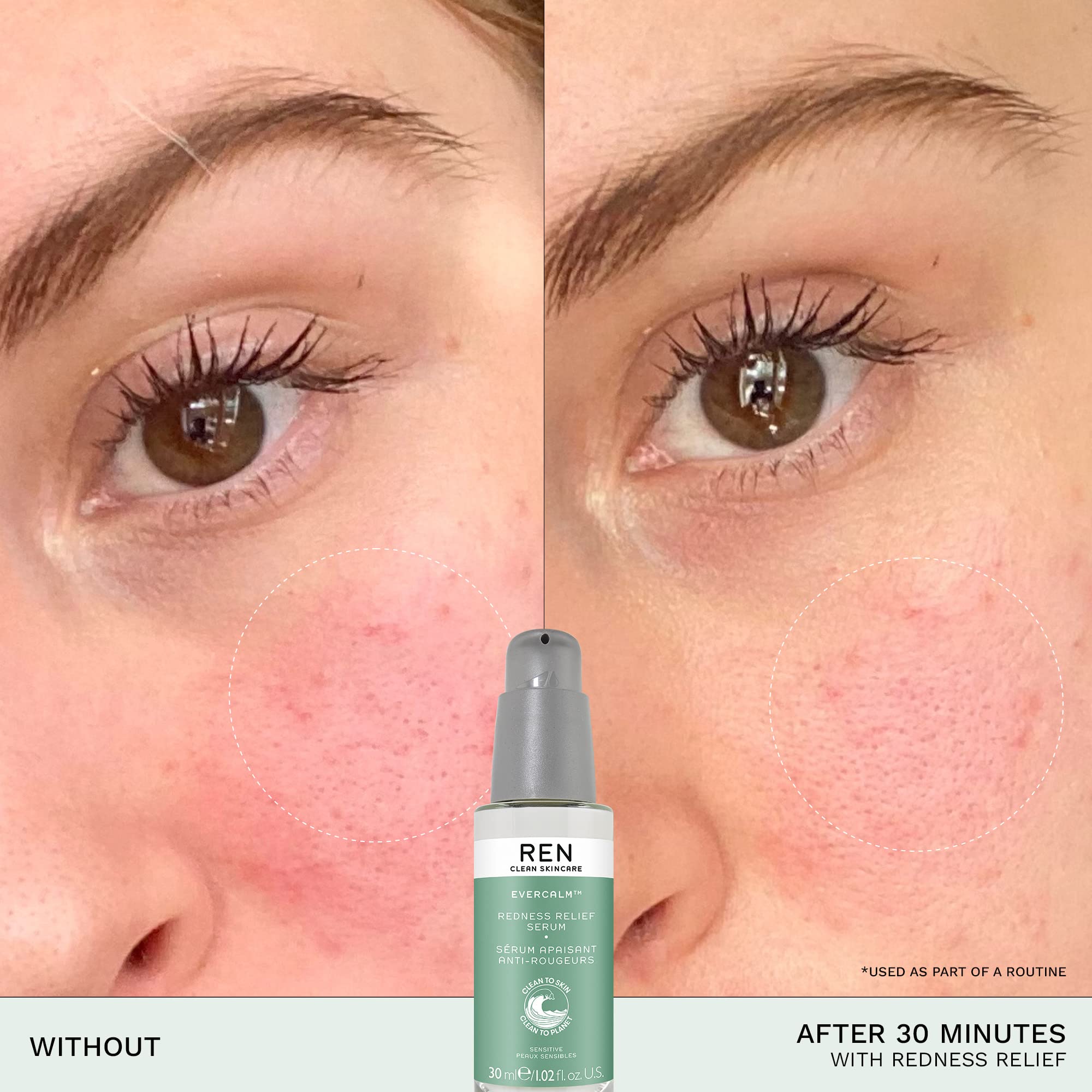 REN Clean Skincare Evercalm Redness Relief Facial Serum - Clinically Proven to Visibly Reduce Redness After Only 30 Minutes, Proven to Strengthen the Skin Barrier, Formulated for Sensitive Skin