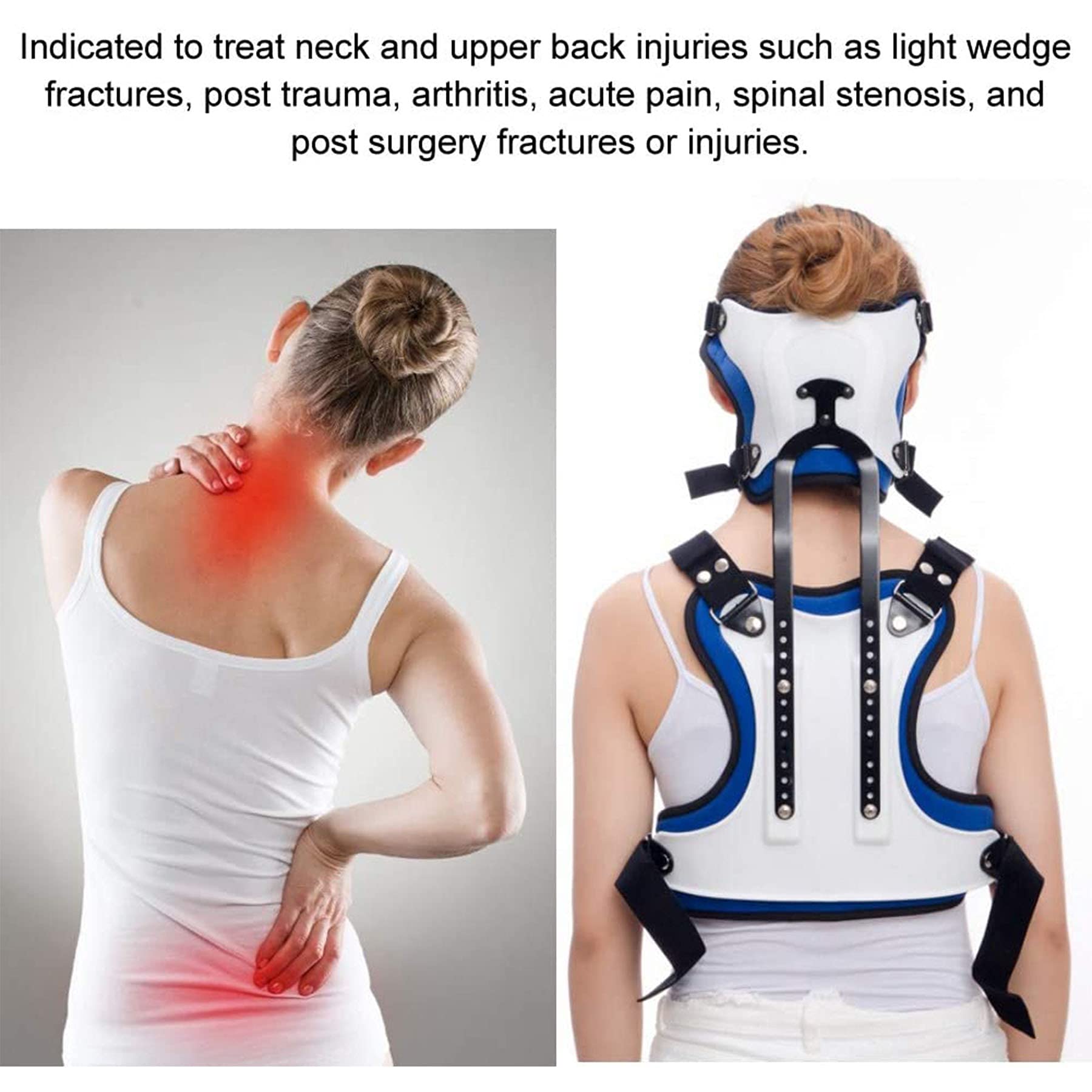 WILLQ Neck Support Orthosis Lumbar Supports Spine Orthosis Thoracolumbar Fixation Spine ​orthosis Back Brace Support Posture Corrector for Cervical Spine Arthritis Fractures Injuries