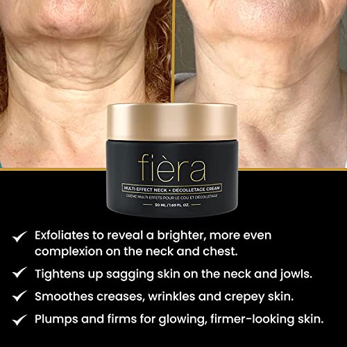 FIÈRA Neck Firming & Tightening Cream - Anti-Aging Moisturizer with Macadamia Oil, Hyaluronic Acid, Shea Butter - Smooths & Lifts Neck Skin - 1.69 FL. OZ. / 50 ML