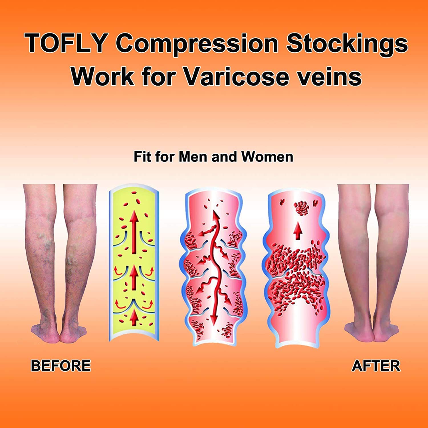 TOFLY® Calf Compression Sleeve for Men & Women, 1 Pair, Footless Compression Socks 20-30mmHg for Leg Support, Shin Splint, Pain Relief, Swelling, Varicose Veins, Maternity, Nursing, Short Beige S