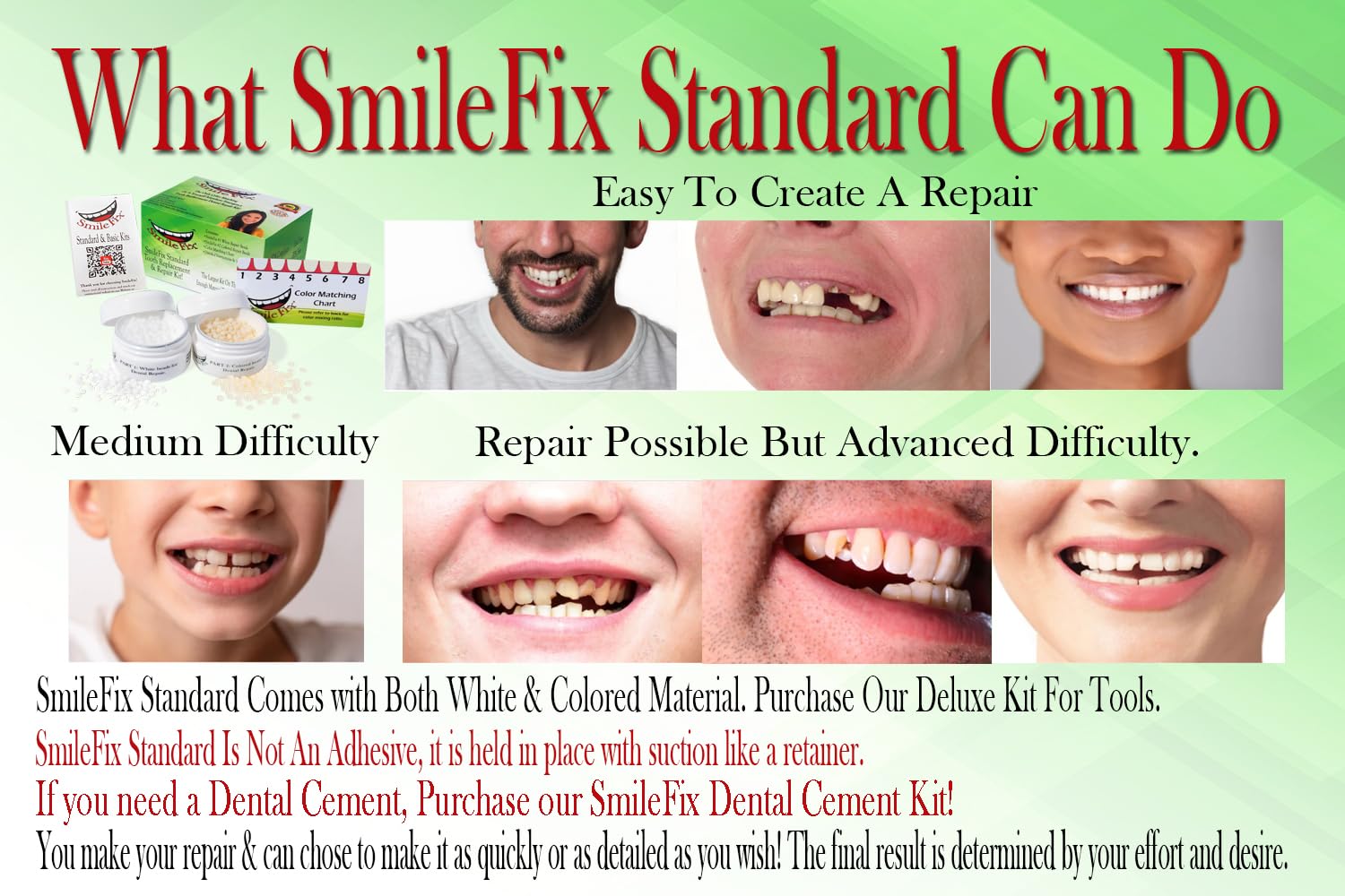 SmileFix Standard Dental Repair Kit - Color Matching Compound - For Missing Or Damaged Teeth - Fix Gaps, Broken Tooth, Spaces - Durable Repair - Fast & Easy - Confident Smiles