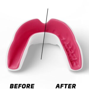 Legenda Sports Mouthguard for Kids (w/Case), Professional Mouthguard for Boxing, MMA, Karate, Football, BJJ, Martial Arts, Rugby, Lacrosse, Hockey (White/Pink)