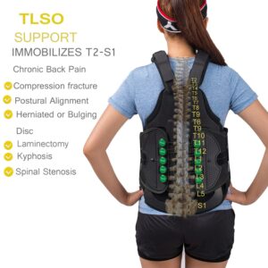 TODDOBRA TLSO Thoracic Full Back Brace for Men and Women - Universal Treat Kyphosis, Compression Fractures, Osteoporosis, Upper Spine Injuries, and Pre or Post Surgery with Hard Lumbar Support ( Size XXL)