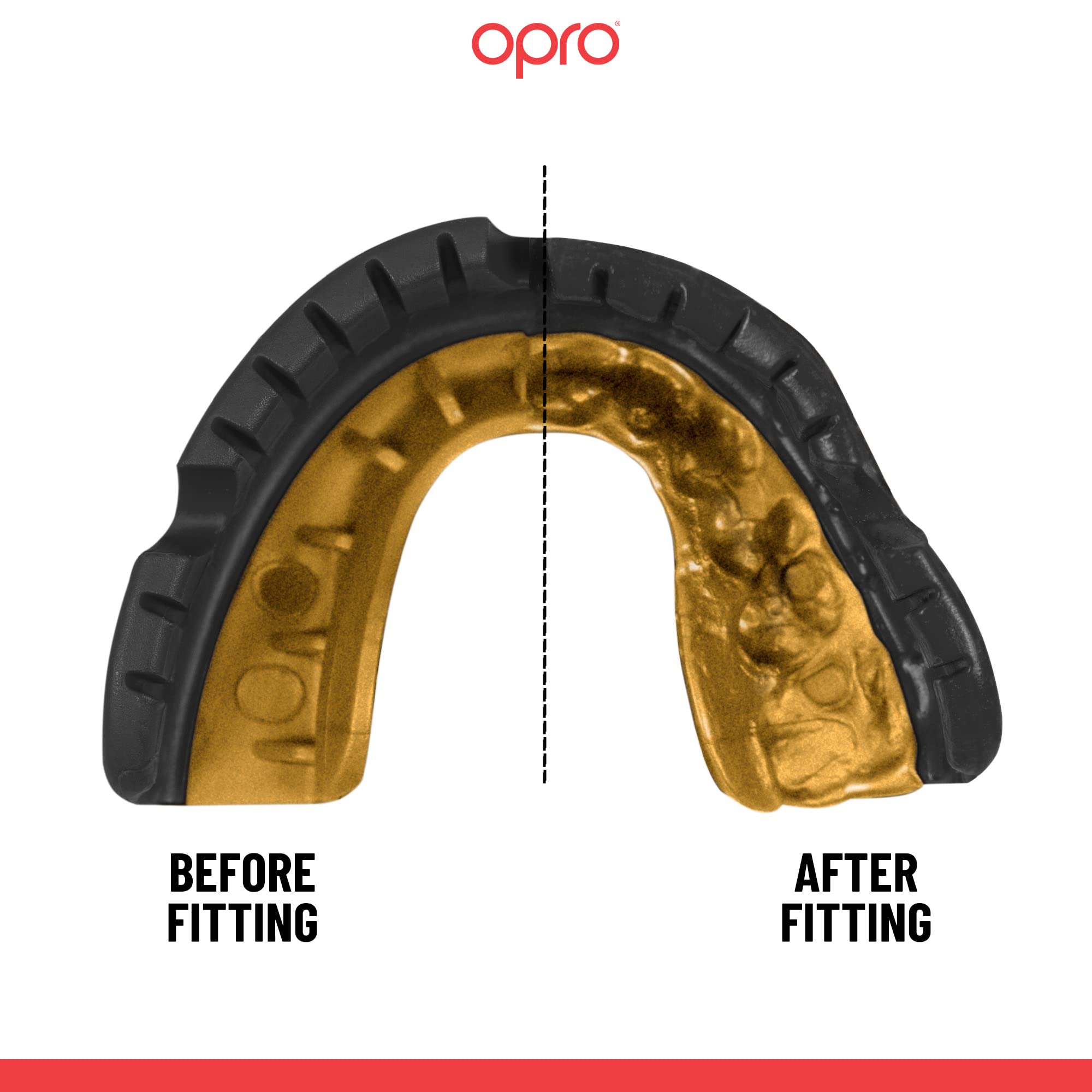 OPRO Gold Level Mouthguard For Braces + Strap, Adults and Youth Sports Mouth Guard, Featuring Revolutionary Fitting Technology for Football, Lacrosse, Hockey, Combat and Contact Sports (Black)