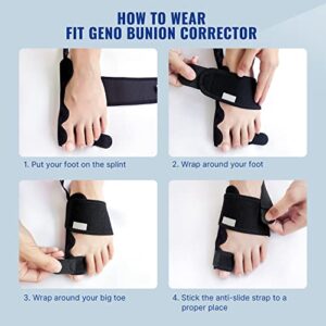 Fitgeno Bunion Corrector Women & Men Big Toe: Foot Straightener Splint Brace - Adjustable Bunyan Correction Orthopedic for Hallux Valgus Pain Relief 2 Pcs