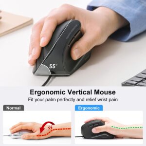 SANWA Wired Ergonomic Mouse, Optical Vertical Computer Mice, Silent Noiseless Click, Reduce Wrist Strain, (1000/1600 DPI, 6 Buttons) Compatible with MacBook, Laptop, Windows, Mac OS