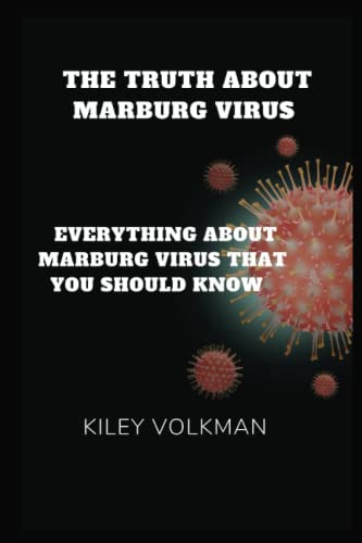 THE TRUTH ABOUT MARBURG VIRUS: Everything about Marburg virus that you should know