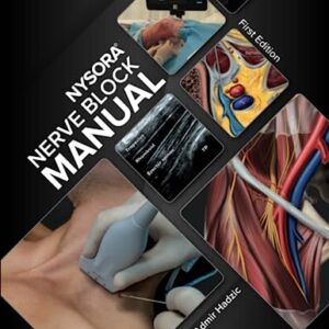 NYSORA Nerve Block Manual: First Edition