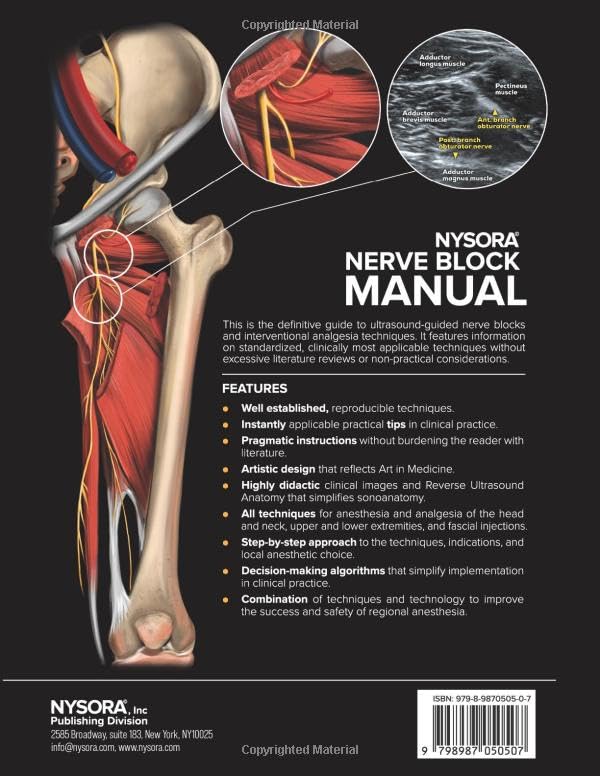 NYSORA Nerve Block Manual: First Edition