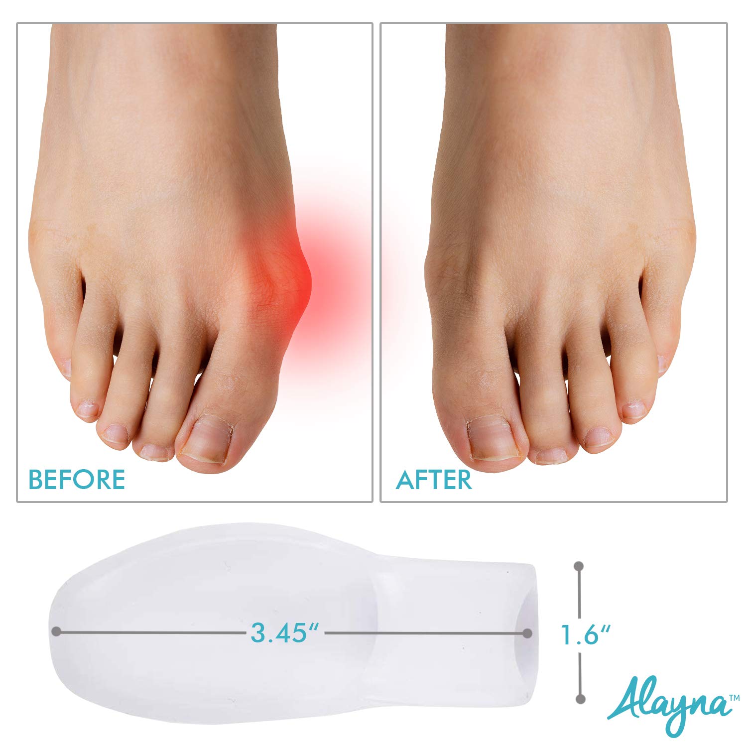 Toe Separators for Overlapping Toes Women Bunion Corrector Toe Spacers 2 Pcs. Bunion Relief Big Toe Gel Cushion Pads Big Toe Spreader Orthopedic Bunion Brace Bunion Guard Wear in Socks & Shoes 1 Pair