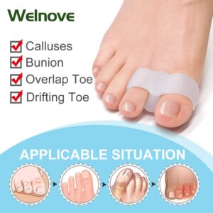 Welnove Pack of 12 Bunion Corrector, Toe Separators with 2 Loops, Big Toe Spacer Suitable for Bunion and Overlap Toe (White)