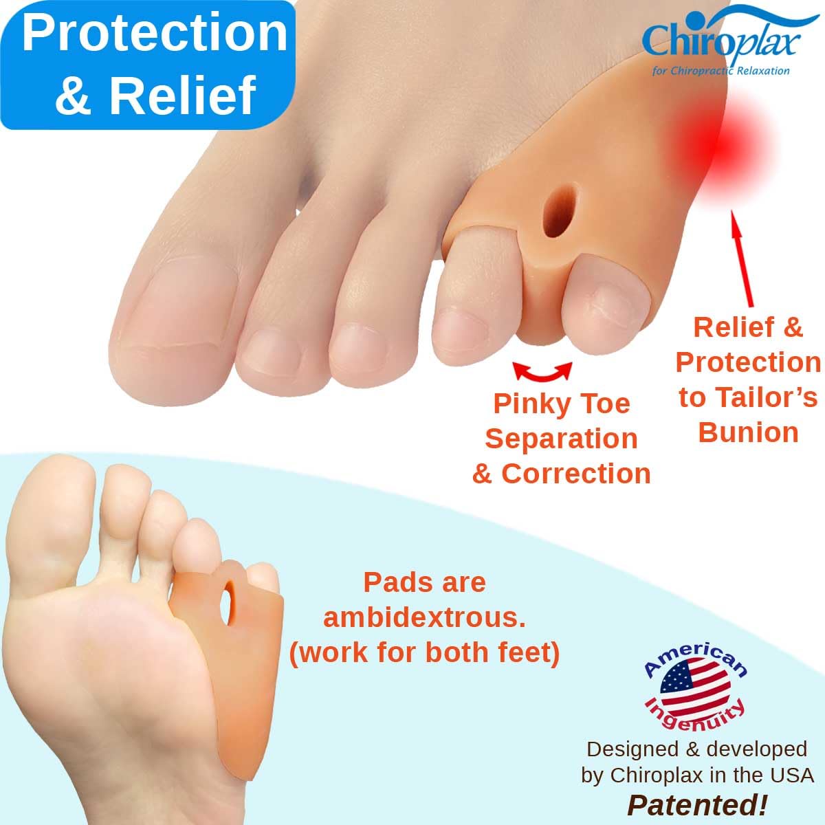 Chiroplax Tailor's Bunion Corrector Pads Bunionette Pain Relief Pinky Little Toe Straightener Separator Cushion Splint Protector Shield Spacer Cover Guard (4 Pads, Shims -Small)