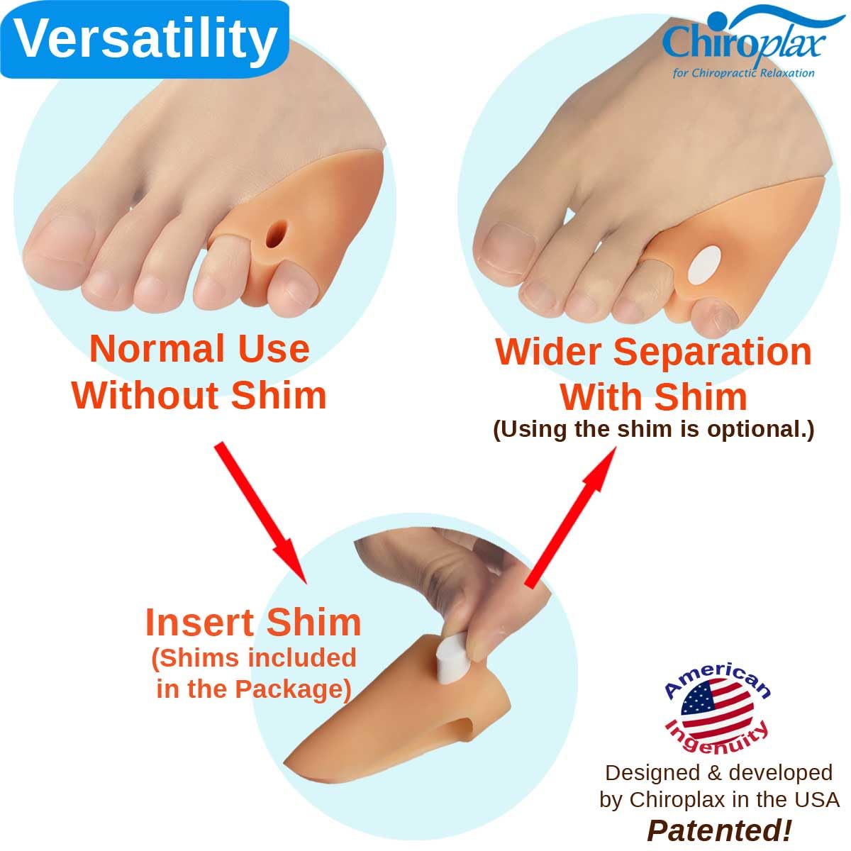 Chiroplax Tailor's Bunion Corrector Pads Bunionette Pain Relief Pinky Little Toe Straightener Separator Cushion Splint Protector Shield Spacer Cover Guard (4 Pads, Shims -Small)