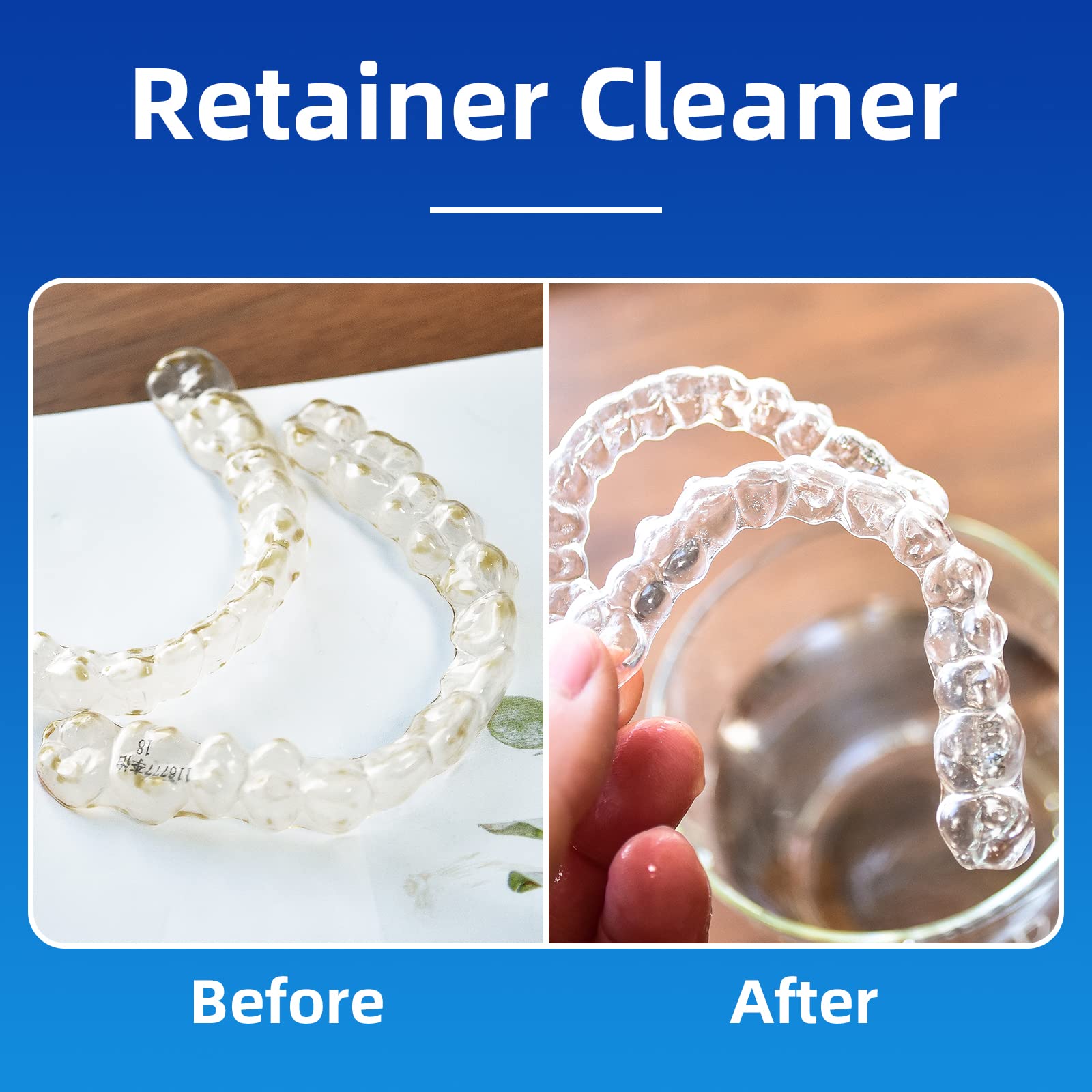 PROJECT BETTER Retainer Cleaner Tablets & Denture Cleaning Tablets for Dental Appliances and Night & Mouth Guard.(36 Counts