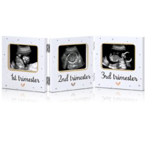 amyhill triple ultrasound picture frames, baby sonogram photo frame pregnancy ultrasound keepsake frame, gift for expecting parents, baby shower baby nursery decor, white