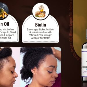 GrowFinity Hair Growth Oil | Biotin and Argan Infused for 3x Faster Growth | Regrowth Treatment | Vitamin E Salon-Grade Natural Oil - 1 Oz