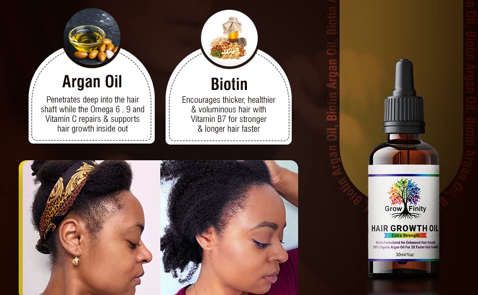 GrowFinity Hair Growth Oil | Biotin and Argan Infused for 3x Faster Growth | Regrowth Treatment | Vitamin E Salon-Grade Natural Oil - 1 Oz