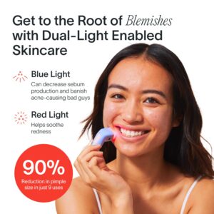 Solawave Bye Acne: 3-Minute Pimple Spot Treatment with Blue Light Therapy and Red Light Therapy - Handheld Device for Breakouts and Face Care