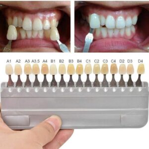 Tooth Shade Guide Teeth Whitening Tool 16 Colors Deachable Teeth Easily for Comparing Tooth Shade Before & After Bleaching