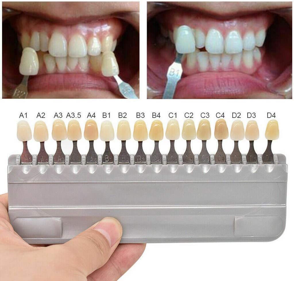 Tooth Shade Guide Teeth Whitening Tool 16 Colors Deachable Teeth Easily for Comparing Tooth Shade Before & After Bleaching