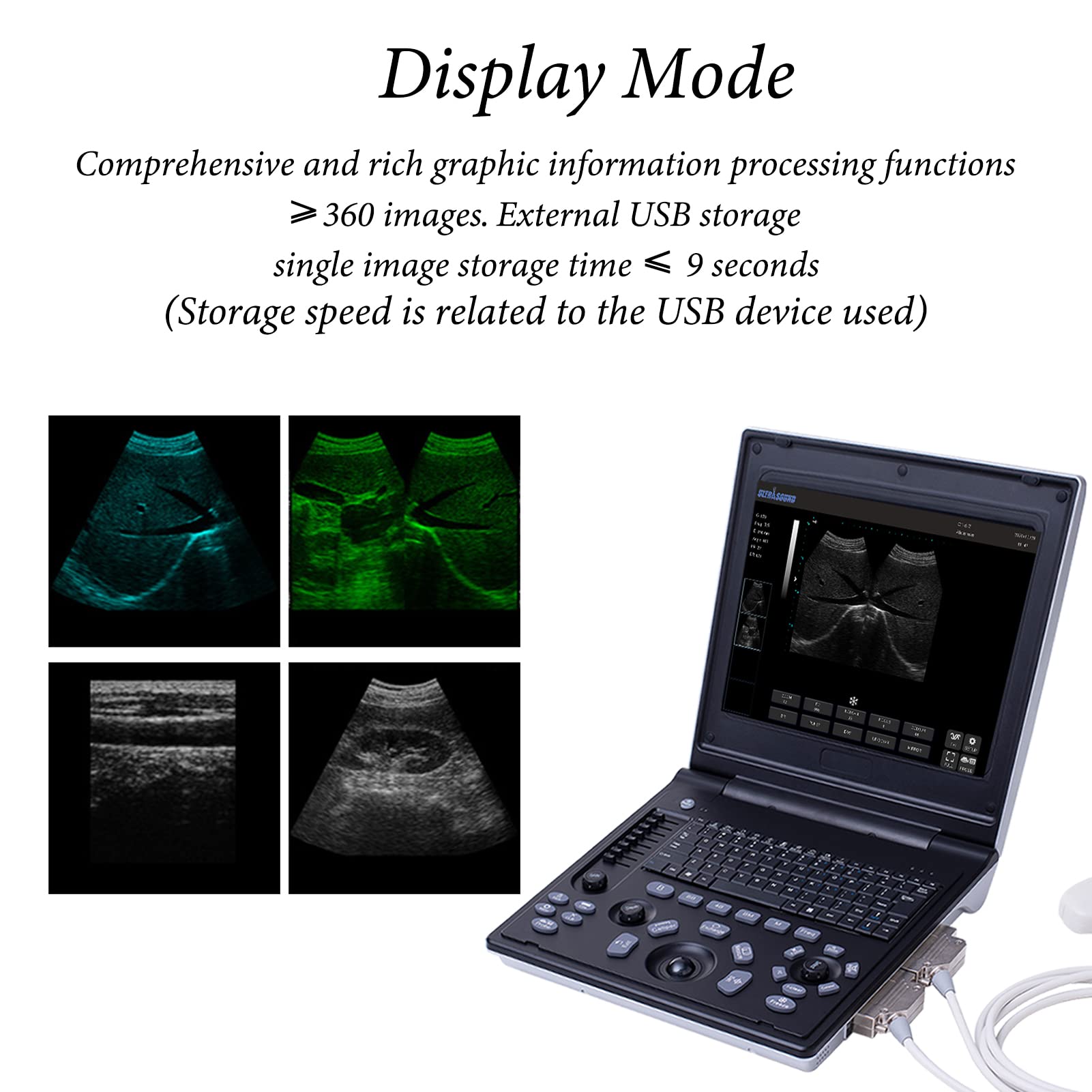 Veterinary B-Ultrasound Machine, Portable Laptop Scanner with 3.5 MHz Micro Convex ​Probe, with 5 Kinds of Pseudo Color and 12-Inch TFT Color Screen, for Cat Dog,Goat,Cow and Pig Pregnancy Tests