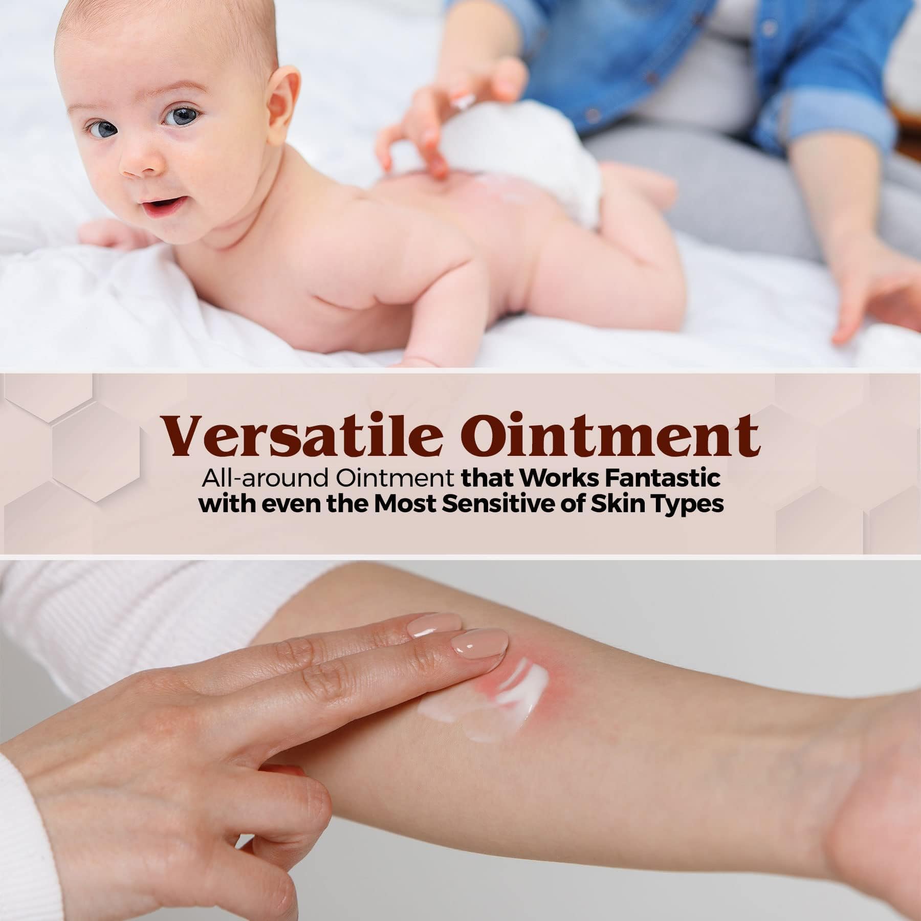 MEDca Vitamin A & D Diaper Rash Ointment- Protectant Cream for Sensitive Baby Skin - Lanolin & Petrolatum Formula, Dry-Cracked Hands/Feet/Face Skin, 1oz Tube, Pack of 4