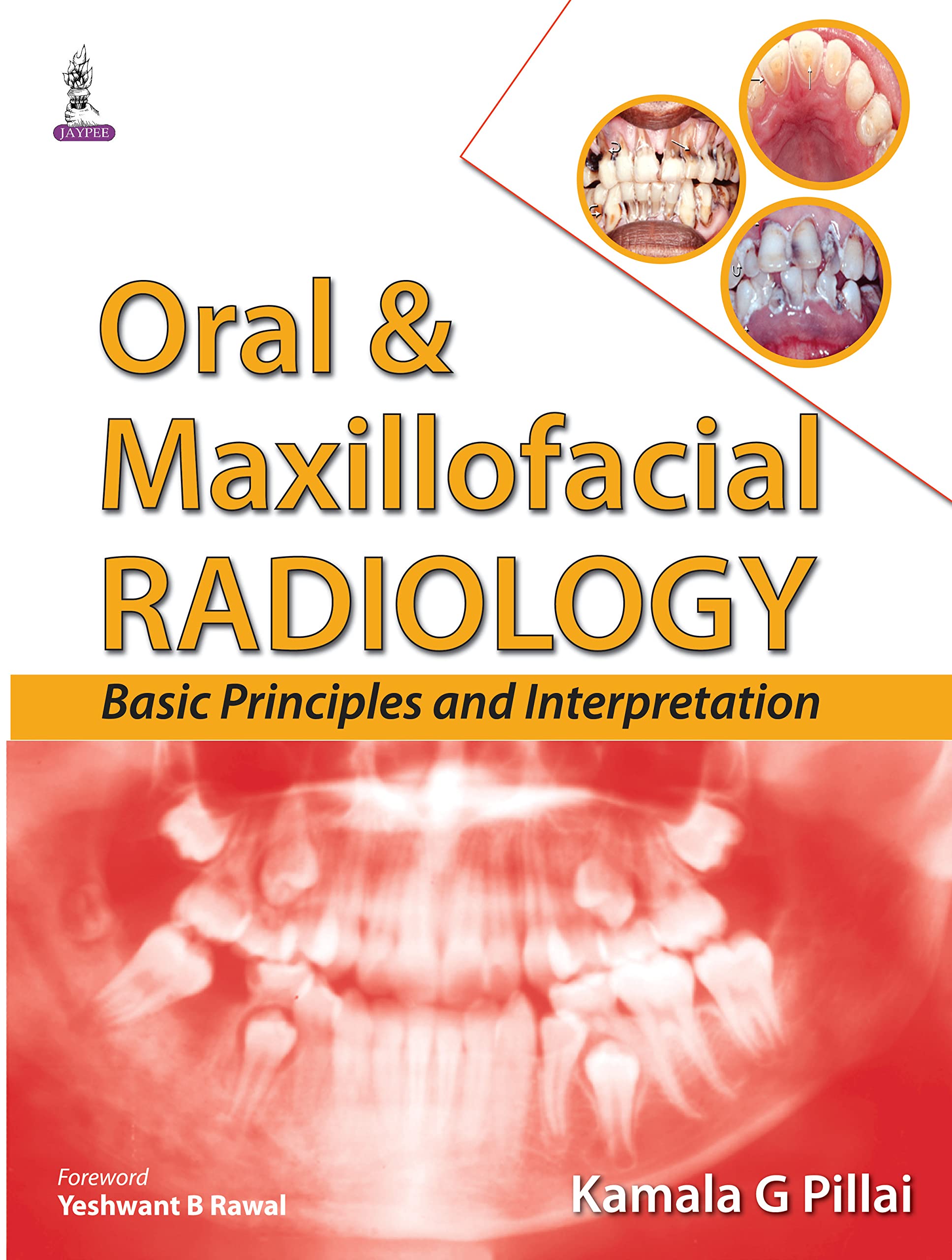 Oral & Maxillofacial Radiology: Basic Principles and Interpretation