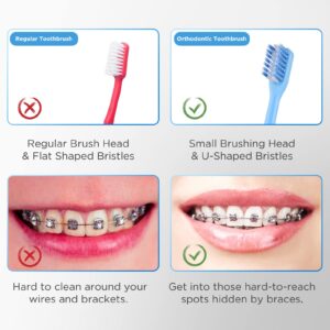 Fremouth V-Shaped Orthodontic Toothbrush for Braces, Soft Bristles, 6 Count, with Interdental Brushes