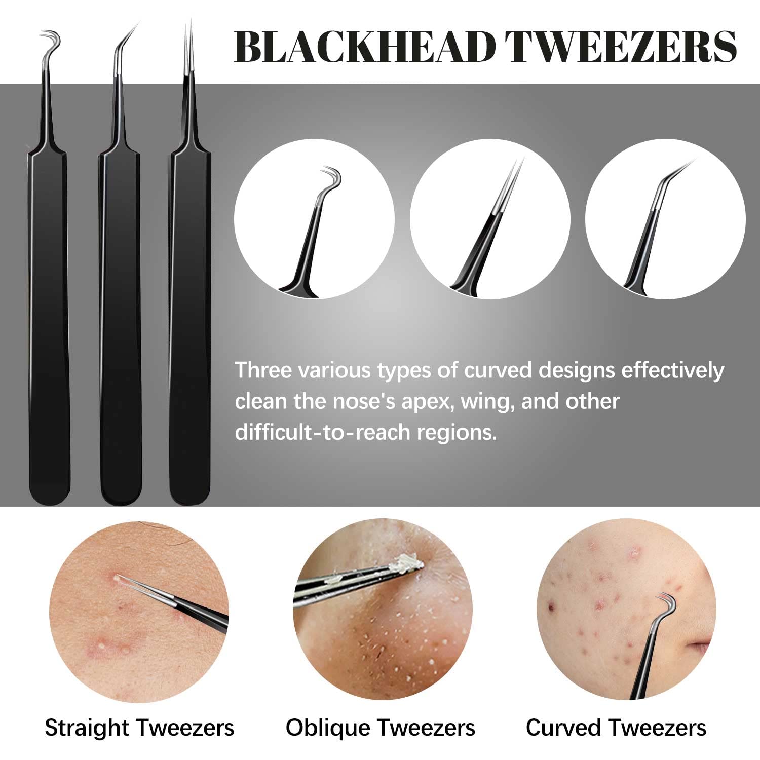 WOAMA Blackhead Remover Tools, Pimple Popper Tool Kit Extraction Acne Tools Blackhead Whitehead Remover Stainless Steel for Nose Face with Black Bag - 9PCS