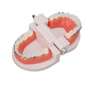 Teeth Model, Dental Teeth Kids Dental Teaching Study Supplies with Metal Bracket Dental Treatment Teeth Model for Dentist Research Dental Laboratory Fake Teeth Braces