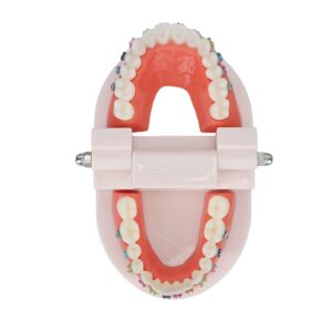 Teeth Model, Dental Teeth Kids Dental Teaching Study Supplies with Metal Bracket Dental Treatment Teeth Model for Dentist Research Dental Laboratory Fake Teeth Braces