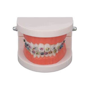 Teeth Model, Dental Teeth Kids Dental Teaching Study Supplies with Metal Bracket Dental Treatment Teeth Model for Dentist Research Dental Laboratory Fake Teeth Braces