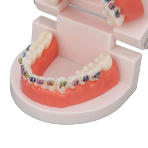 Teeth Model, Dental Teeth Kids Dental Teaching Study Supplies with Metal Bracket Dental Treatment Teeth Model for Dentist Research Dental Laboratory Fake Teeth Braces