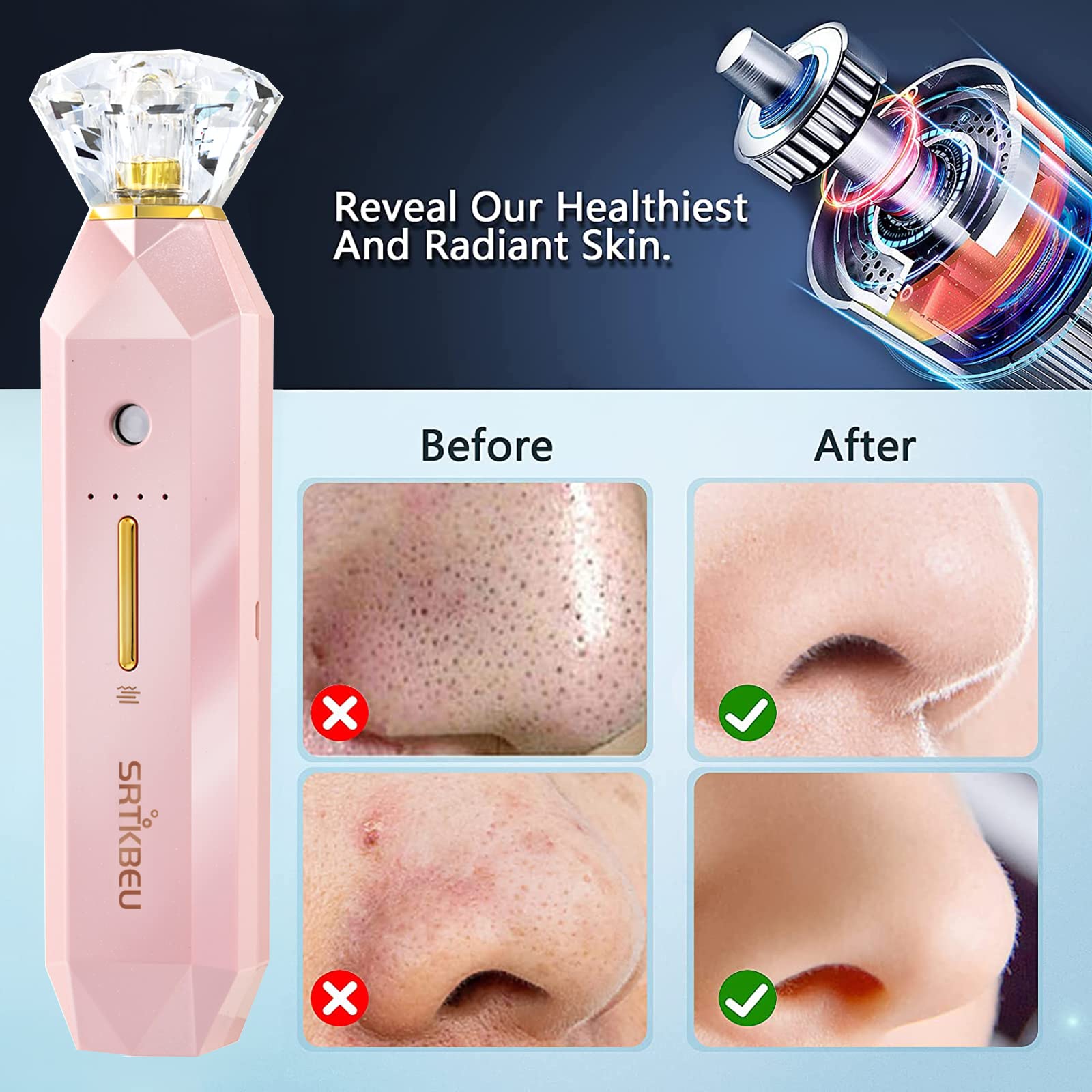 Blackhead Remover Pore Vacuum,Facial Sprayer Oxygen Hydrating,2 in 1 Multifunction Derma Blemish Removal Cleanser, Face Steamer Whitehead Acne Remover, Deeply Spots Cleaner Suction (Pink)