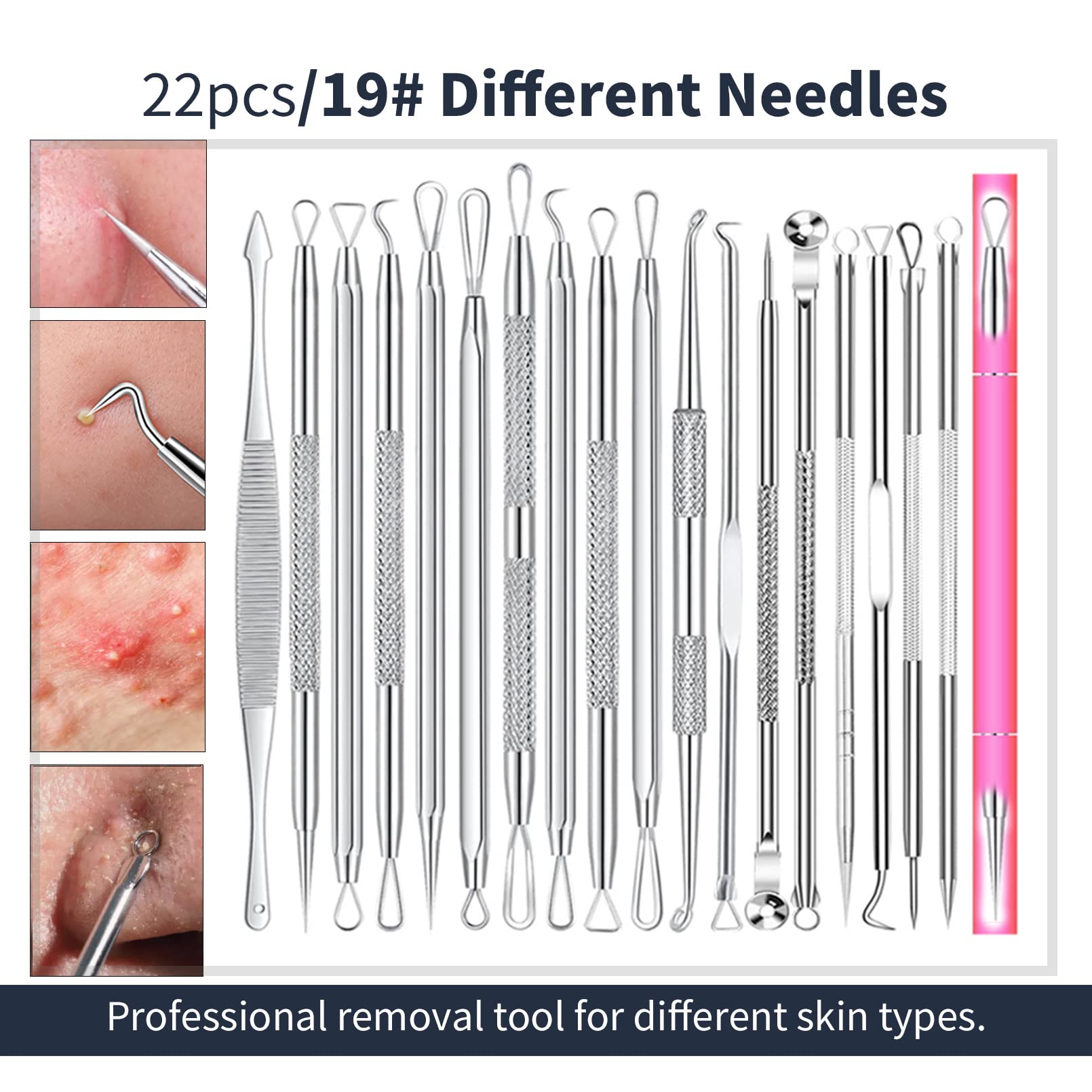 2024 Professional Pimple Popper Tool Kit - 22 PCS Blackhead Remover Tools for Acne and Zit Popping Comedone Extractor with Magnifying Glass and Alcohol Pad