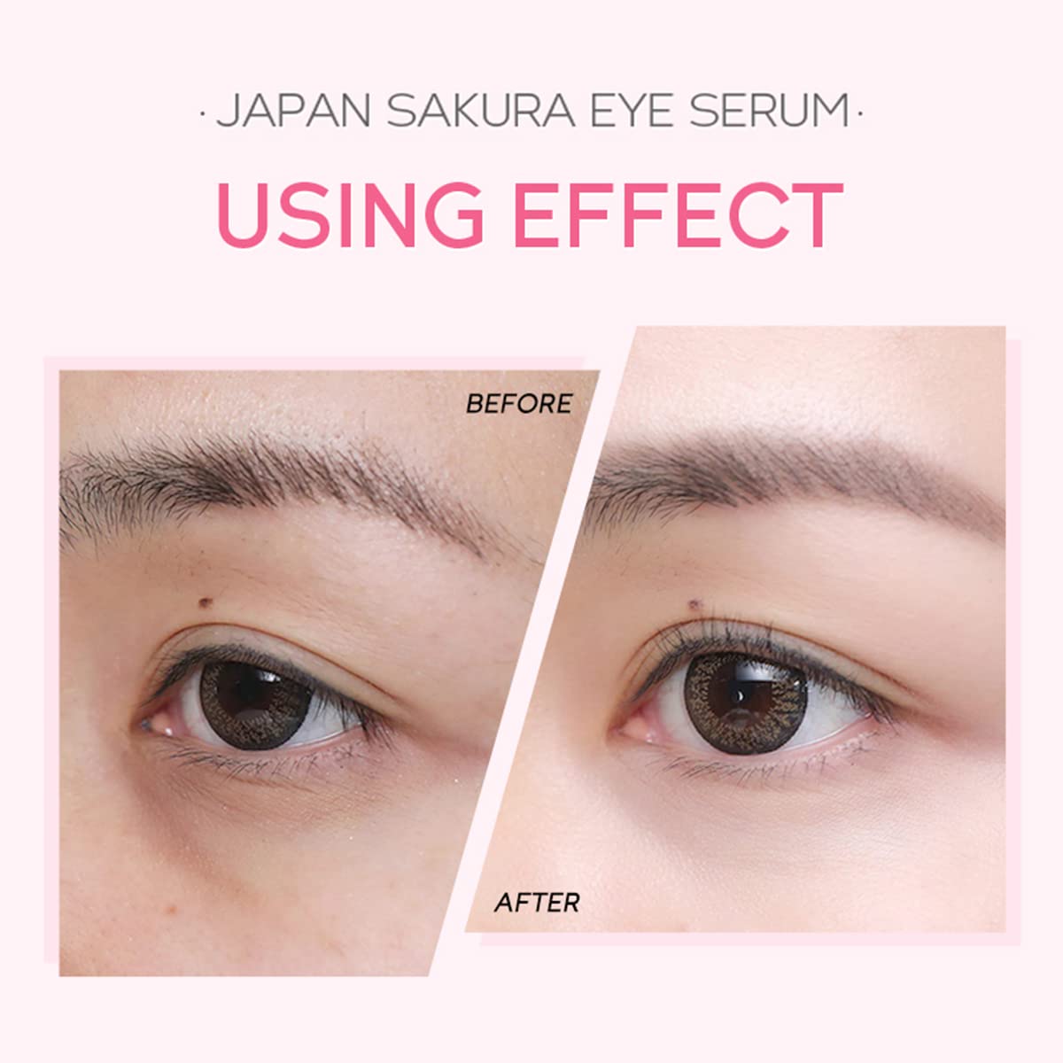 AKARY 2-in-1 Sakura Eye Serum and Eye Roller, Eye Massager Roller Lifting, Eye Cream for Nourishing Relieve Eye Bags, Dark Circles, and Puffiness, Fine Lines, Under Eye Treatment Cream